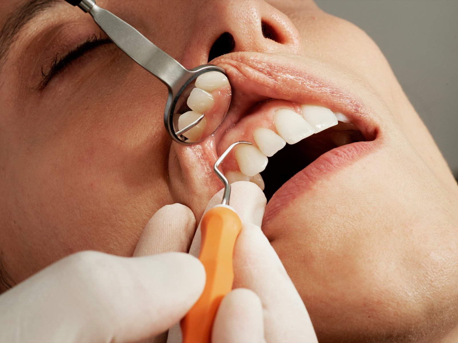 Evaluación dental cuidadosa