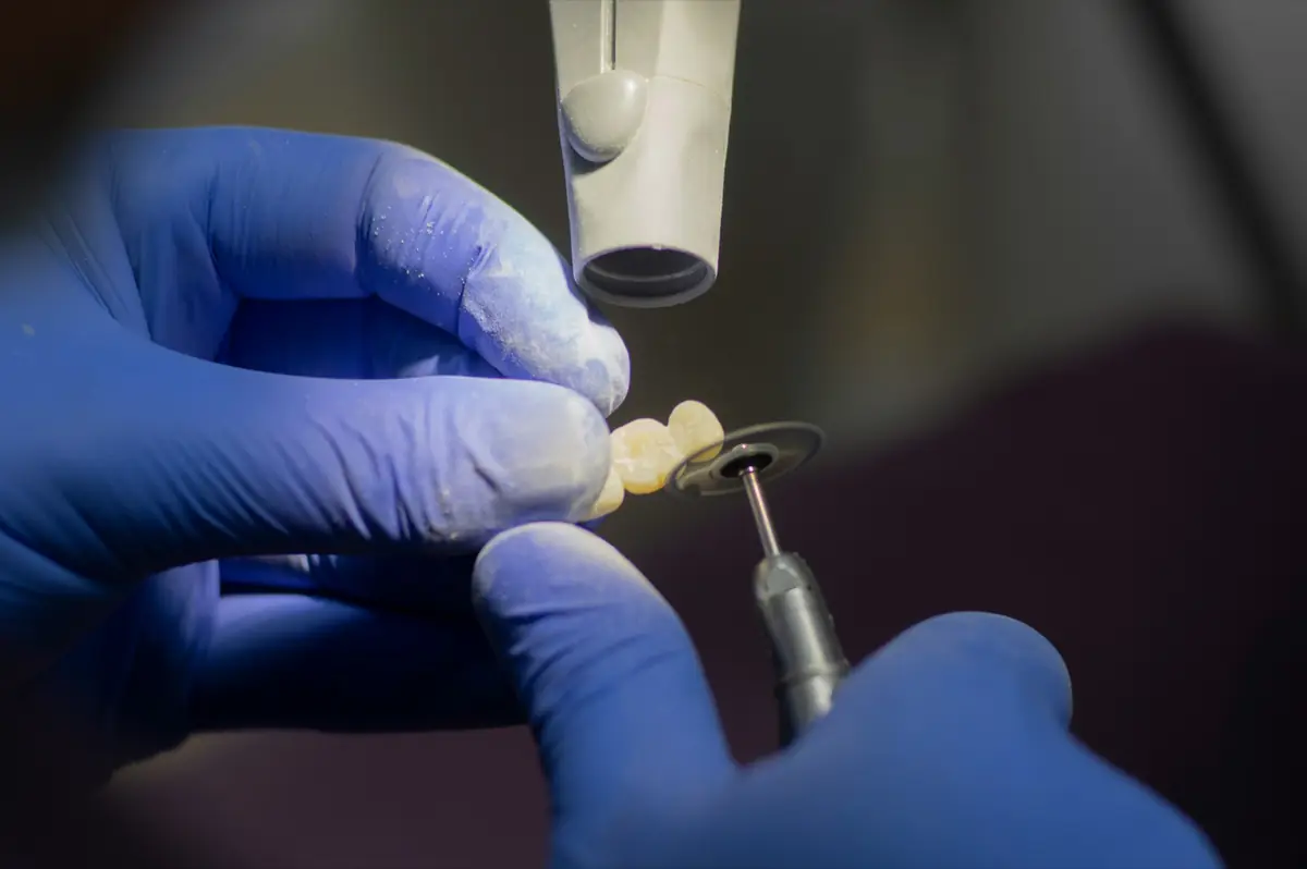 Profesional dental dando acabado a una restauración cerámica