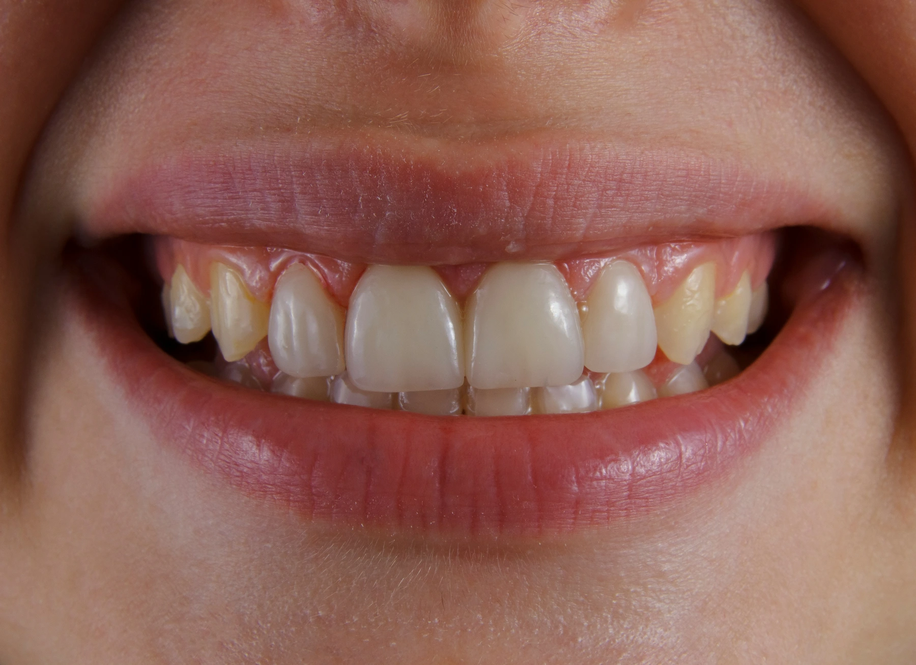 Primer plano de una sonrisa